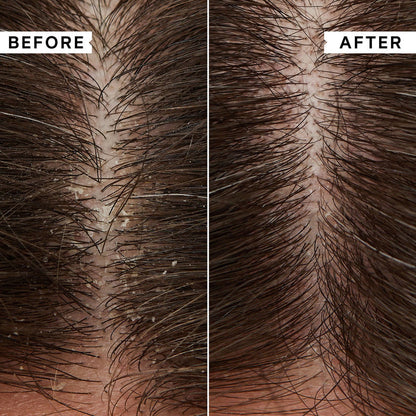 Phillip Kingsley Dry / Itchy Scalp Shampoo